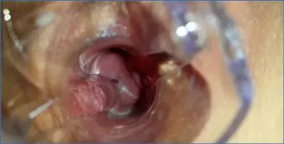 Scat Anna Coprofield Solo in a Messy Through The Speculum Filled Pussy POV Prolapse