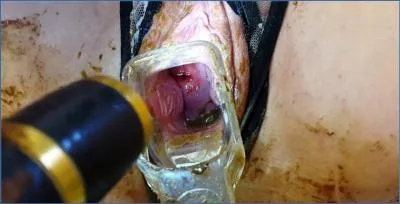 Anna Coprofield's Speculum Play During Menstruation with Farting