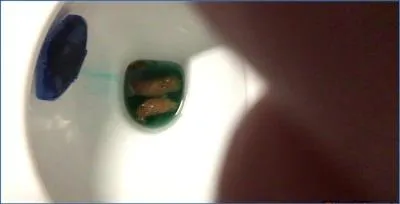 Ella Gilbert Takes Charge with Extreme Toilet Play and Diarrhea