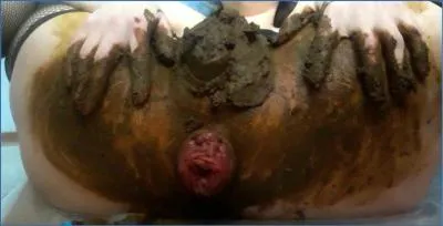 Scatlina's Anal Prolapse and Shit Eating Dildo Show - Scat/Copro Porn